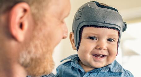 Babys schlafen am sichersten in der Rückenlage. Dadurch kann sich die noch weiche Schädeldecke verändern und der Kopf sich asymmetrisch verformen. Diese ungewollte Deformation des Kinderschädels kann korrigiert werden. Die Experten von STOLLE beraten