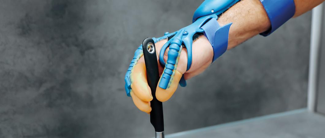 Die exomotion® hand one von HKK Bionic ist ein echtes Wunder der Technik, Foto: HKK Bionic